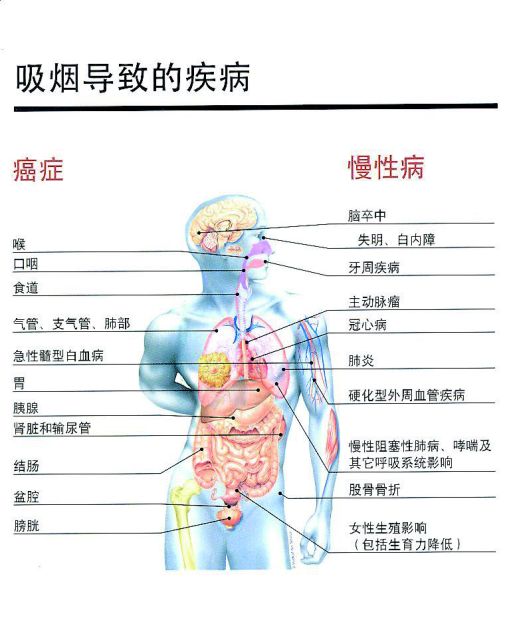 珍爱生命 远离烟草